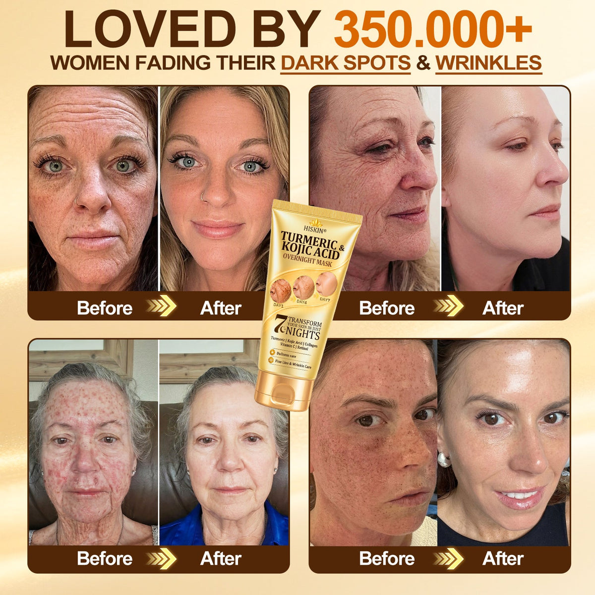 🎁 𝐇𝐢𝐬𝐤𝐢𝐧® Exclusive Offer | Only 5 Boxes Left — Get an Extra 80% OFF Today on the Turmeric × Kojic Acid Overnight Peel-Off Mask. Grab Yours Before It’s Gone! 🎁