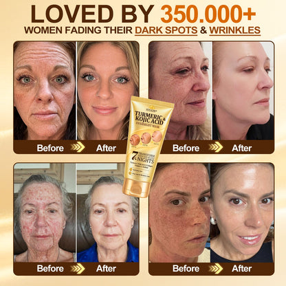 🎁 𝐇𝐢𝐬𝐤𝐢𝐧® Exclusive Offer | Only 5 Boxes Left — Get an Extra 80% OFF Today on the Turmeric × Kojic Acid Overnight Peel-Off Mask. Grab Yours Before It’s Gone! 🎁