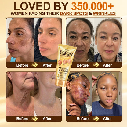 🎁 𝐇𝐢𝐬𝐤𝐢𝐧® Exclusive Offer | Only 5 Boxes Left — Get an Extra 80% OFF Today on the Turmeric × Kojic Acid Overnight Peel-Off Mask. Grab Yours Before It’s Gone! 🎁