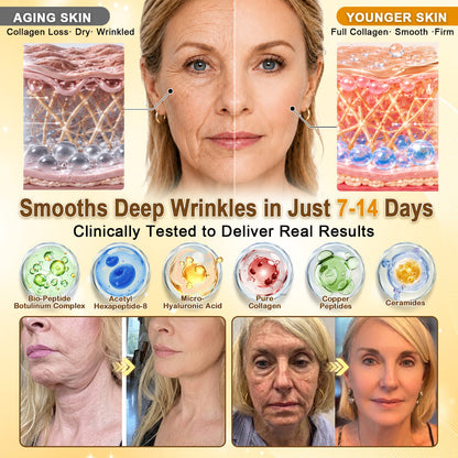 🎁 𝐇𝐢𝐬𝐤𝐢𝐧® Exclusive Offer | Only 5 Boxes Left — Get an Extra 80% OFF Today on the Turmeric × Kojic Acid Overnight Peel-Off Mask. Grab Yours Before It’s Gone! 🎁