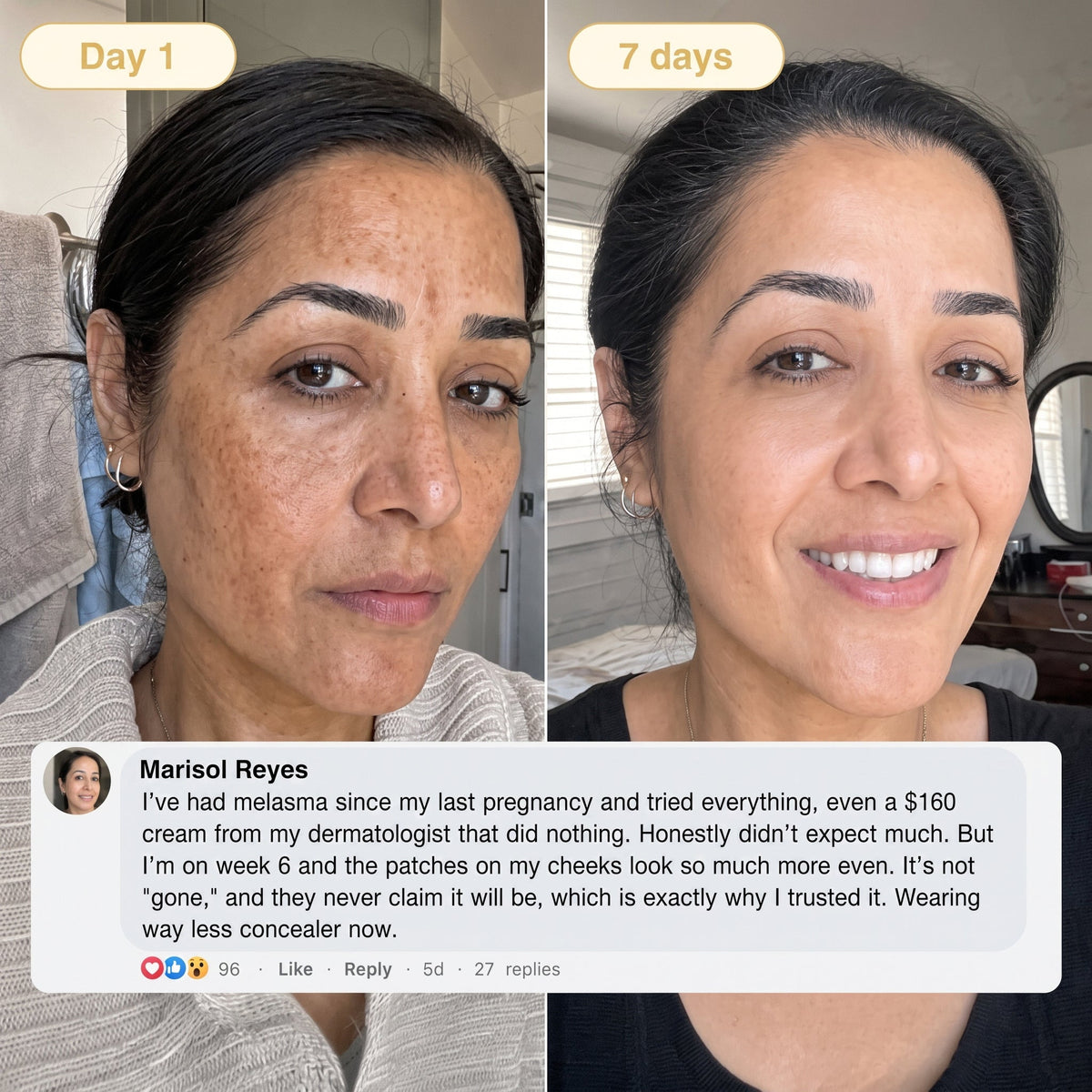 🎁 𝐇𝐢𝐬𝐤𝐢𝐧® Exclusive Offer | Only 5 Boxes Left — Get an Extra 80% OFF Today on the Turmeric × Kojic Acid Overnight Peel-Off Mask. Grab Yours Before It’s Gone! 🎁