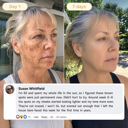 🎁 𝐇𝐢𝐬𝐤𝐢𝐧® Exclusive Offer | Only 5 Boxes Left — Get an Extra 80% OFF Today on the Turmeric × Kojic Acid Overnight Peel-Off Mask. Grab Yours Before It’s Gone! 🎁