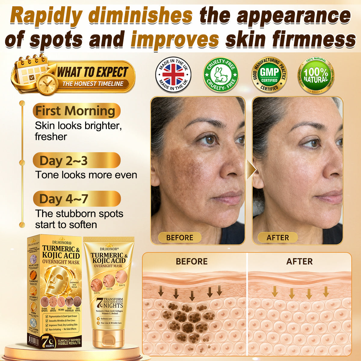 🎁 𝐇𝐢𝐬𝐤𝐢𝐧® Exclusive Offer | Only 5 Boxes Left — Get an Extra 80% OFF Today on the Turmeric × Kojic Acid Overnight Peel-Off Mask. Grab Yours Before It’s Gone! 🎁