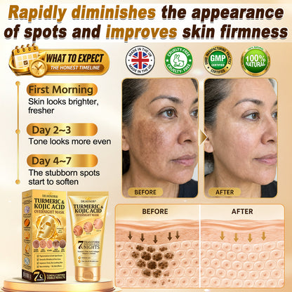 🎁 𝐇𝐢𝐬𝐤𝐢𝐧® Exclusive Offer | Only 5 Boxes Left — Get an Extra 80% OFF Today on the Turmeric × Kojic Acid Overnight Peel-Off Mask. Grab Yours Before It’s Gone! 🎁