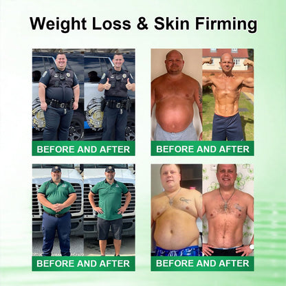 𝑶𝒇𝒇𝒊𝒄𝒊𝒂𝒍 𝑺𝒕𝒐𝒓𝒆  |🍀🍀𝐃𝐑.𝐇𝐎𝐍𝐎𝐑® 𝐋𝐲𝐦𝐩𝐡𝐚𝐭𝐢𝐜 𝐃𝐫𝐚𝐢𝐧𝐚𝐠𝐞 𝐒𝐥𝐢𝐦𝐦𝐢𝐧𝐠 𝐍𝐚𝐧𝐨-𝐌𝐢𝐜𝐫𝐨𝐧𝐞𝐞𝐝𝐥𝐞 𝐏𝐚𝐭𝐜𝐡 🇬🇧 (𝐉𝐮𝐬𝐭 𝐨𝐧𝐜𝐞 𝐚 𝐝𝐚𝐲, 𝐯𝐢𝐬𝐢𝐛𝐥𝐞 𝐜𝐡𝐚𝐧𝐠𝐞𝐬 𝐢𝐧 𝟕 𝐝𝐚𝐲𝐬）𝘽𝙚𝙧𝙗𝙚𝙧𝙞𝙣𝙚 + 𝙈𝙤𝙧𝙞𝙣𝙜𝙖 𝙁𝙤𝙧𝙢𝙪𝙡𝙖 ✅ 𝐅𝐨𝐫 𝐨𝐛𝐞𝐬𝐢𝐭𝐲, 𝗟𝗼𝗼𝘀𝗲 𝘀𝗸𝗶𝗻,𝐝𝐢𝐚𝐛𝐞𝐭𝐞𝐬, 𝐬𝐥𝐞𝐞𝐩 𝐚𝐩𝐧𝐞𝐚, 𝐣𝐨𝐢𝐧𝐭 𝐢𝐬𝐬𝐮𝐞𝐬, 𝐚𝐧𝐝 𝐦𝐨𝐫𝐞💯💯